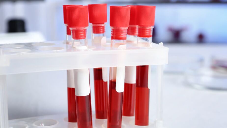 Tubos de laboratorio para exámenes de resistencia a la insulina