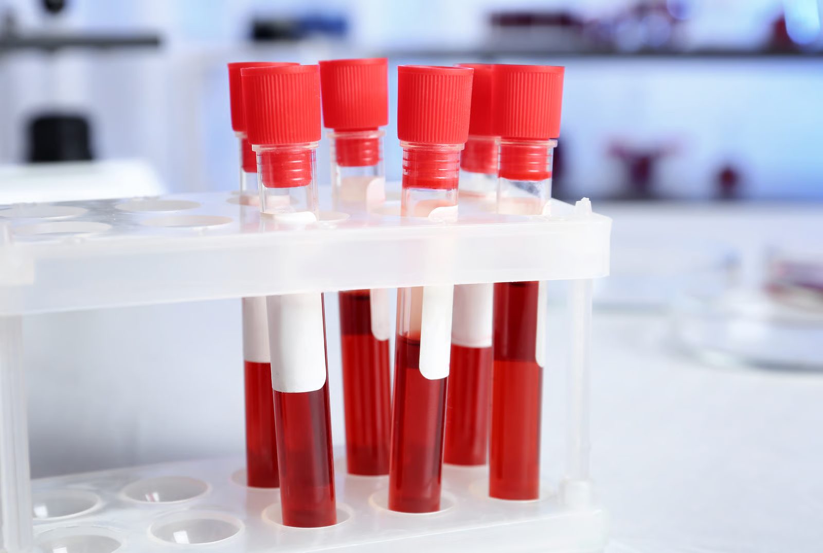 Tubos de laboratorio para exámenes de resistencia a la insulina